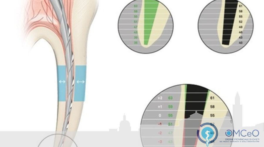 Clicca per accedere all'articolo " L'endodonzia oggi, le nuove prospettive "